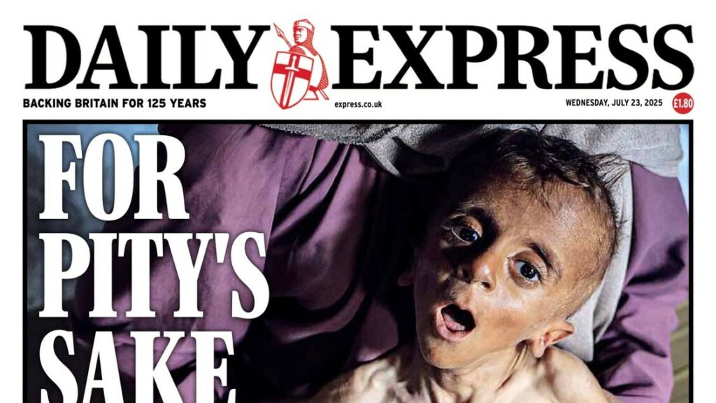 Gaza, bimbo come uno scheletro, Muhammad sciocca il mondo - Notizie