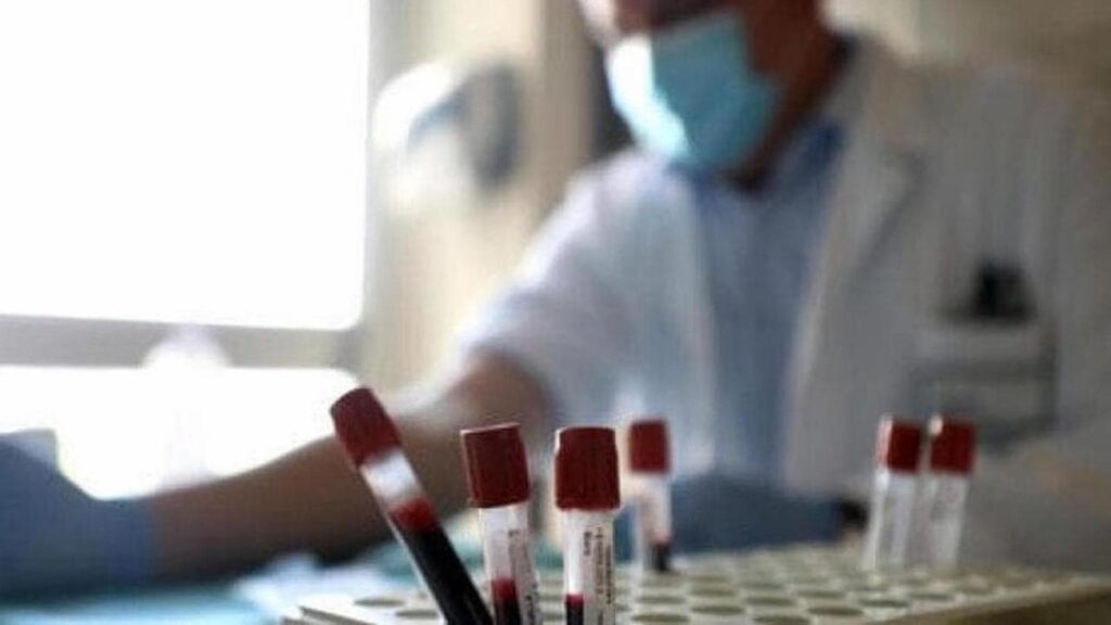 Botulino, dieci casi in pochi giorni: altri due giovani intossicati a Cosenza dopo gli 8 a Cagliari