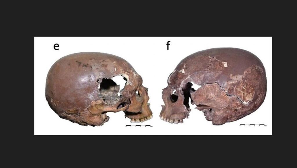E’ un ligure dell’era glaciale il primo europeo con il cranio intenzionalmente modificato