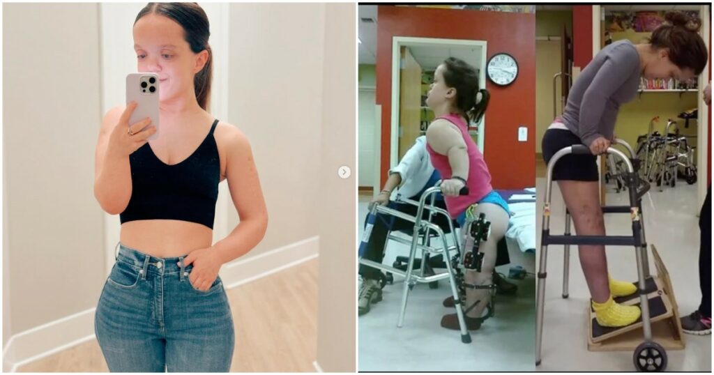 “Non mi sono mai sentita nana, ma odiavo essere trattata come una cane da esposizione. Ora sono una ‘bassa comoda’”: la storia di Chandler Crews, che ha speso 2 milioni per farsi allungare gambe e braccia “Non mi sono mai sentita nana, ma odiavo essere trattata come una cane da esposizione. Ora sono una 'bassa comoda'": la storia di Chandler Crews, che ha speso 2 milioni per farsi allungare gambe e braccia